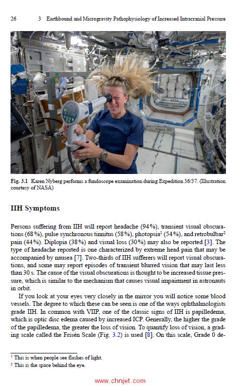 《Microgravity and Vision Impairments in Astronauts》